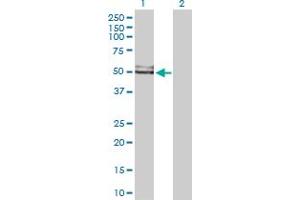 Western Blot analysis of GDI1 expression in transfected 293T cell line by GDI1 MaxPab polyclonal antibody. (GDI1 Antikörper  (AA 1-447))