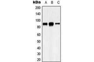 Western blot analysis of Cadherin 8 expression in U87MG (A), HeLa (B), SHSY5Y (C) whole cell lysates. (Cadherin 8 Antikörper  (Center))