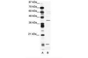 Image no. 1 for anti-CAMP Responsive Element Modulator (CREM) (AA 19-68) antibody (ABIN202021) (CREM Antikörper  (AA 19-68))
