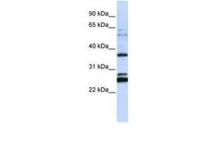Image no. 1 for anti-Family with Sequence Similarity 70, Member A (FAM70A) (AA 108-157) antibody (ABIN6738344) (FAM70A Antikörper  (AA 108-157))