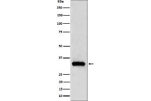 Western blot analysis of NDUFAF1 expression in 293T cell lysate.