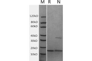 2μg of IFN-γ, Mouse was resolved with SDS-PAGE under reducing (R) and non-reducing (N) conditions and visualized by Coomassie Blue staining. (Interferon gamma Protein (IFNG) (AA 23-155))