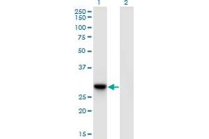 Western Blot analysis of DNAJC27 expression in transfected 293T cell line by DNAJC27 monoclonal antibody (M09), clone 3C1. (DNAJC27 Antikörper  (AA 1-273))
