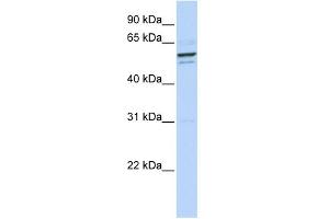 WB Suggested Anti-GPNMB Antibody Titration:  1 ug/ml  Positive Control:  293T cells lysate