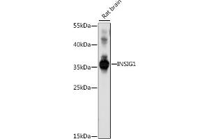 Western blot analysis of extracts of rat brain, using INSIG1 antibody (ABIN7267887) at 1:1000 dilution. (INSIG1 Antikörper  (C-Term))