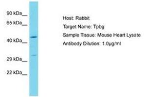 Image no. 1 for anti-Trophoblast Glycoprotein (TPBG) (N-Term) antibody (ABIN6750266) (TPBG Antikörper  (N-Term))