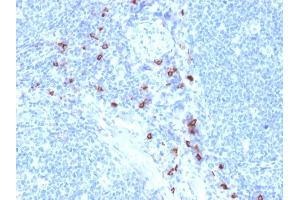 Formalin-fixed, paraffin-embedded human Tonsil stained with Tryptase Mouse Monoclonal Antibody (TPSAB1/1963). (TPSAB1 Antikörper  (AA 115-233))