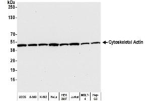 Western Blotting (WB) image for anti-Cytoskeletal Actin (CIMG_00972) (N-Term) antibody (ABIN7453594) (Cytoskeletal Actin (CIMG_00972) (N-Term) Antikörper)