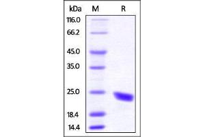 Mouse CD40 Ligand, His Tag on SDS-PAGE under reducing (R) condition.