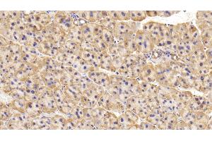 Detection of TH in Rat Adrenal gland Tissue using Polyclonal Antibody to Tyrosine Hydroxylase (TH)