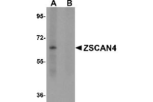 Western Blotting (WB) image for anti-Zinc Finger and SCAN Domain Containing 4 (ZSCAN4) (C-Term) antibody (ABIN1030831) (ZSCAN4 Antikörper  (C-Term))