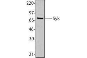 Western Blotting (WB) image for anti-Spleen tyrosine Kinase (SYK) (AA 5-360) antibody (ABIN2665374) (SYK Antikörper  (AA 5-360))