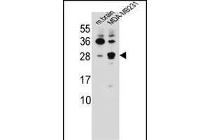 CBLN2 Antibody (C-term) (ABIN655780 and ABIN2845215) western blot analysis in mouse brain tissue and MDA-M cell line lysates (35 μg/lane). (CBLN2 Antikörper  (C-Term))