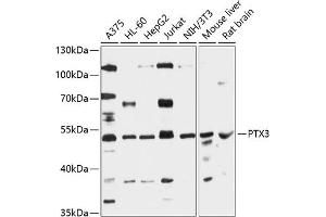 Western blot analysis of extracts of various cell lines, using PTX3 antibody (ABIN6129313, ABIN6146488, ABIN6146490 and ABIN6216395) at 1:3000 dilution. (PTX3 Antikörper  (AA 18-240))