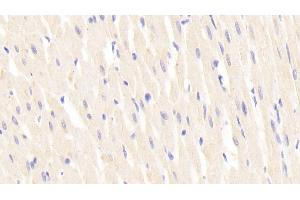 Detection of LAMb2 in Rat Cardiac Muscle Tissue using Polyclonal Antibody to Laminin Beta 2 (LAMb2) (LAMB2 Antikörper  (AA 939-1129))