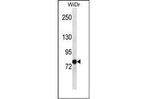 Western blot analysis of LZTS2 Antibody