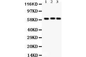 Anti- Heparanase 1 Picoband antibody, Western blotting All lanes: Anti Heparanase 1  at 0. (HPSE Antikörper  (Middle Region))