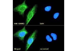 (ABIN570984) Immunofluorescence analysis of paraformaldehyde fixed Neuro2a cells, permeabilized with 0. (CaMKII alpha/beta (Internal Region) Antikörper)