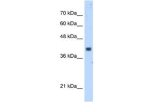 Western Blotting (WB) image for anti-Prenyl (Decaprenyl) Diphosphate Synthase, Subunit 1 (PDSS1) antibody (ABIN2462955) (PDSS1 Antikörper)