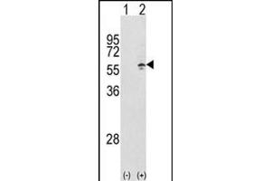 Western blot analysis of CCT3 (arrow) using rabbit polyclonal CCT3 Antibody (Center) (ABIN389422 and ABIN2839505). (CCT3 Antikörper  (AA 298-326))