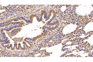 Immunohistochemistry (IHC) image for anti-Cathepsin S (CTSS) (AA 115-331) antibody (ABIN7434368)
