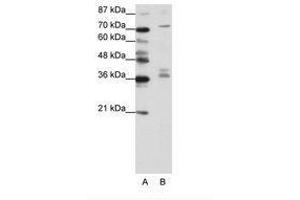 Image no. 1 for anti-A Kinase (PRKA) Anchor Protein (Yotiao) 9 (AKAP9) (N-Term) antibody (ABIN203051) (AKAP9 Antikörper  (N-Term))