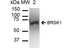 Western blot analysis of Mouse Brain cell lysates showing detection of ~85. (BRSK1 Antikörper  (Atto 390))