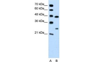 Western Blotting (WB) image for anti-Claudin 18 (CLDN18) antibody (ABIN2462406) (Claudin 18 Antikörper)