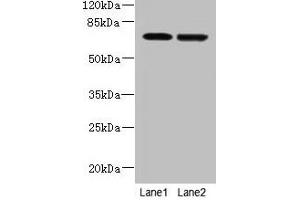 Western blot All lanes: NETO2 antibody at 4 μg/mL Lane 1: U251 whole cell lysate Lane 2: MDA-MB-231 whole cell lysate Secondary Goat polyclonal to rabbit IgG at 1/10000 dilution Predicted band size: 60, 23, 59 kDa Observed band size: 70 kDa (NETO2 Antikörper  (AA 378-525))