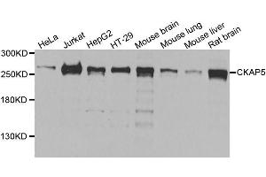 Western blot analysis of extracts of various cell lines, using CKAP5 antibody (ABIN5996436) at 1/1000 dilution. (CKAP5 Antikörper)