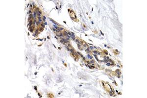 Immunohistochemistry of paraffin-embedded human normal breast using PKLR antibody at dilution of 1:200 (400x lens). (PKLR Antikörper)