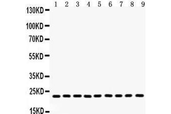 Peroxiredoxin 1 Antikörper  (Middle Region)