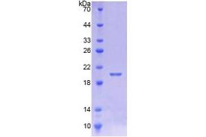SDS-PAGE analysis of Human CALML5 Protein. (CALML5 Protein)