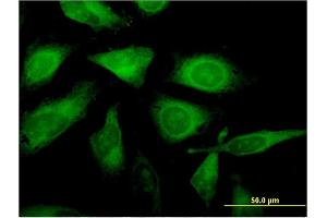 Immunofluorescence of monoclonal antibody to C1orf89 on HeLa cell. (RSG1 Antikörper  (AA 1-258))