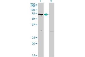 Western Blot analysis of EPB42 expression in transfected 293T cell line by EPB42 monoclonal antibody (M01), clone 2G12.