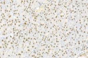 Immunohistochemistry analysis of paraffin-embedded rat pancreas using,IOP2 (ABIN7074883) at dilution of 1: 2000 (NARF Antikörper)