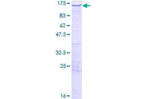 PDZ Domain Containing Ring Finger 4 (PDZRN4) (AA 1-778) protein (GST tag)