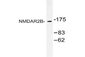 Western blot (WB) analysis of NMDAR2B antibody in extracts from Jurkat cells. (GRIN2B Antikörper)