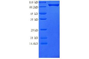 Colony Stimulating Factor 3 Receptor (Granulocyte) (CSF3R) (AA 25-620) protein (GST tag) (CSF3R Protein (AA 25-620) (GST tag))