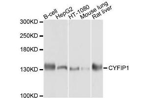 Western blot analysis of extracts of various cell lines, using CYFIP1 antibody. (CYFIP1 Antikörper  (AA 1-270))