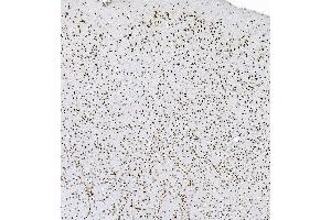 IHC analysis of hnRNP D/AUF1/HNRNPD using anti-hnRNP D/AUF1/HNRNPD antibody (ABIN7602592). (HNRNPD/AUF1 Antikörper  (AA 88-246))