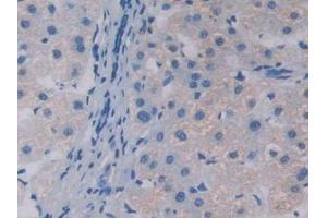 DAB staining on IHC-P; Samples: Human Liver Tissue (APOA5 Antikörper  (AA 167-335))