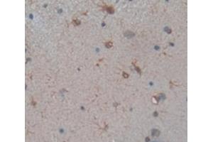 IHC-P analysis of Rat Tissue, with DAB staining. (SLC6A3 Antikörper  (AA 562-619))