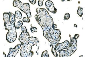 IHC analysis of B Raf/BRAF using anti-B Raf/BRAF antibody (ABIN3043761). (BRAF Antikörper  (AA 38-230))