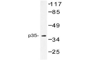 Image no. 1 for anti-Cyclin-Dependent Kinase 5, Regulatory Subunit 1 (p35) (CDK5R1) antibody (ABIN272233) (CDK5R1 Antikörper)