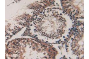 IHC-P analysis of Mouse Testis Tissue, with DAB staining. (MAP1A Antikörper  (AA 2552-2759))