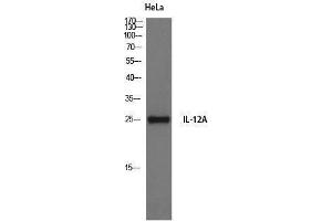 Western Blotting (WB) image for anti-Interleukin 12 alpha (IL12A) (Internal Region) antibody (ABIN3185157)
