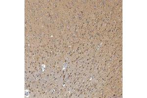 IHC analysis of SNPH using anti-SNPH antibody (ABIN7601724). (Syntaphilin Antikörper  (AA 43-482))