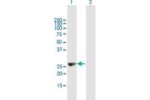 Western Blot analysis of KIFC2 expression in transfected 293T cell line by KIFC2 MaxPab polyclonal antibody. (KIFC2 Antikörper  (AA 1-226))