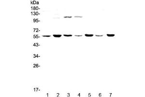 Western blot testing of human 1) HeLa, 2) MDA-MB-453, 3) Jurkat, 4) HepG2, 5) SK-OV-3, 6) PANC-1 and 7) mouse thymus lysate with CHRNA3 antibody at 0.